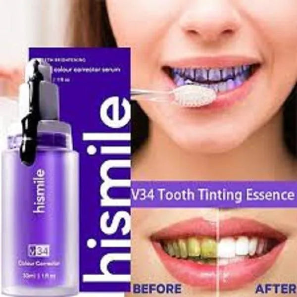 Teeth Whitening Serum 30ml – Purple Brightening Formula for Stain Removal & Whiter Teeth